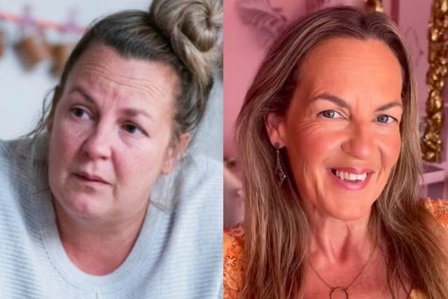 <p>Lorraine Stanley put on a whopping seven stone with surgery - and now regrets it </p>